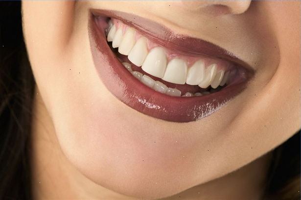 Gum sygdommen kaldes også paradentose. Antiseptisk "chip".