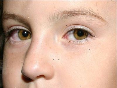 Hvordan til at behandle post nasal drop i børn