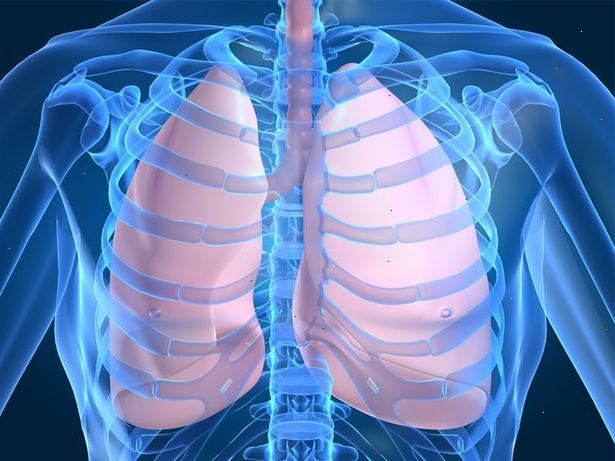 Årsager og symptomer på lungebetændelse. Lungebetændelse er en sygdom, der forårsager betændelse i lungerne.