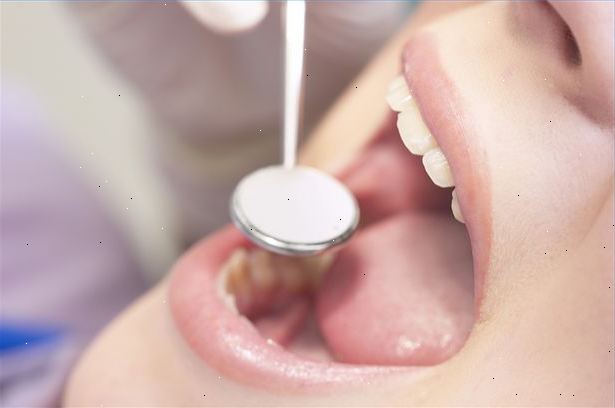 Hvordan styrer gingivitis at forbedre hjerte sundhed. Rådfør dig med din tandlæge.